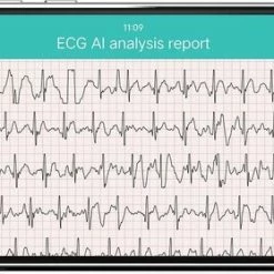 Goedkoop 🛒 Belesy® MARS - Smartwatch Dames - Smartwatch Heren - Horloge - Bloeddruk - ECG - Stappenteller - 1.3 Inch - Kleurenscherm - Full Touch - Zilver - Staal - Schakel 🔔 47 Goedkoop 🛒 Belesy® MARS - Smartwatch Dames - Smartwatch Heren - Horloge - Bloeddruk - ECG - Stappenteller - 1.3 Inch - Kleurenscherm - Full Touch - Zilver - Staal - Schakel 🔔 -Sieraden-horloges Winkel 550x279 1
