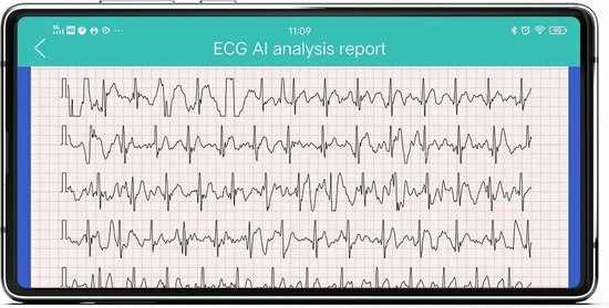 Goedkoop 🛒 Belesy® MARS - Smartwatch Dames - Smartwatch Heren - Horloge - Bloeddruk - ECG - Stappenteller - 1.3 Inch - Kleurenscherm - Full Touch - Zilver - Staal - Schakel 🔔 25 Goedkoop 🛒 Belesy® MARS - Smartwatch Dames - Smartwatch Heren - Horloge - Bloeddruk - ECG - Stappenteller - 1.3 Inch - Kleurenscherm - Full Touch - Zilver - Staal - Schakel 🔔 - Afbeelding 23