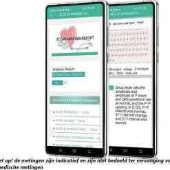 Goedkoop 🛒 Belesy® MARS - Smartwatch Dames - Smartwatch Heren - Horloge - Bloeddruk - ECG - Stappenteller - 1.3 Inch - Kleurenscherm - Full Touch - Zilver - Staal - Schakel 🔔 30 Goedkoop 🛒 Belesy® MARS - Smartwatch Dames - Smartwatch Heren - Horloge - Bloeddruk - ECG - Stappenteller - 1.3 Inch - Kleurenscherm - Full Touch - Zilver - Staal - Schakel 🔔 -Sieraden-horloges Winkel 550x527 3