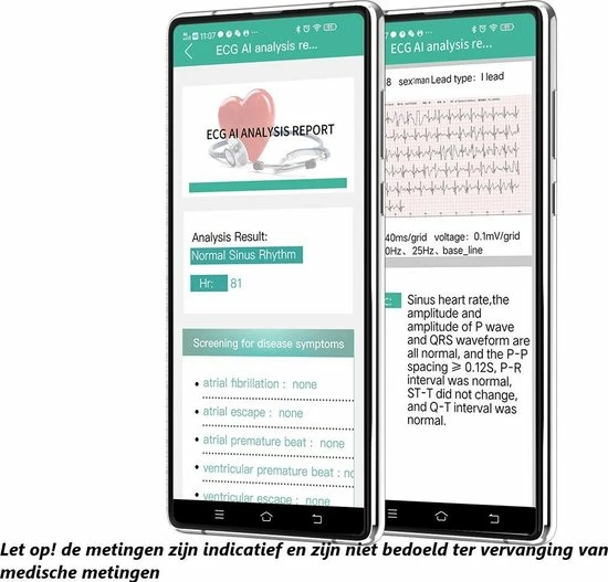 Goedkoop 🛒 Belesy® MARS - Smartwatch Dames - Smartwatch Heren - Horloge - Bloeddruk - ECG - Stappenteller - 1.3 Inch - Kleurenscherm - Full Touch - Zilver - Staal - Schakel 🔔 8 Goedkoop 🛒 Belesy® MARS - Smartwatch Dames - Smartwatch Heren - Horloge - Bloeddruk - ECG - Stappenteller - 1.3 Inch - Kleurenscherm - Full Touch - Zilver - Staal - Schakel 🔔 - Afbeelding 6